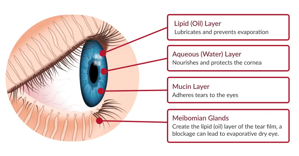 Diagram of an eye showing four labeled parts: Lipid (Oil) Layer lubricates and prevents evaporation; Aqueous (Water) Layer nourishes and protects the cornea; Mucin Layer adheres tears to the eyes; Meibomian Glands create the lipid layer of the tear film and blockage can cause dry eye.