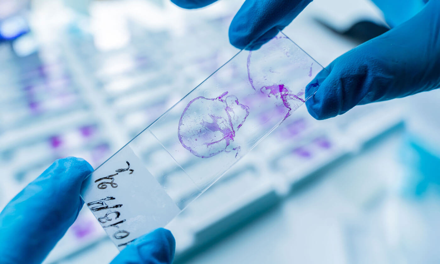 HER2 IHC quantification with AI