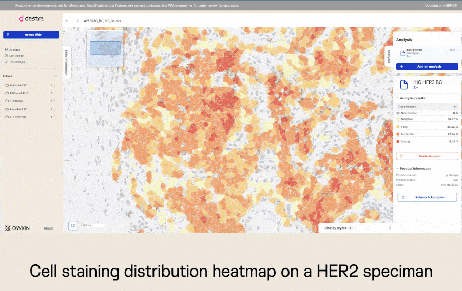 Cell-level staining quantification for HER2 prediction using a lightweight IHC-specific foundation model