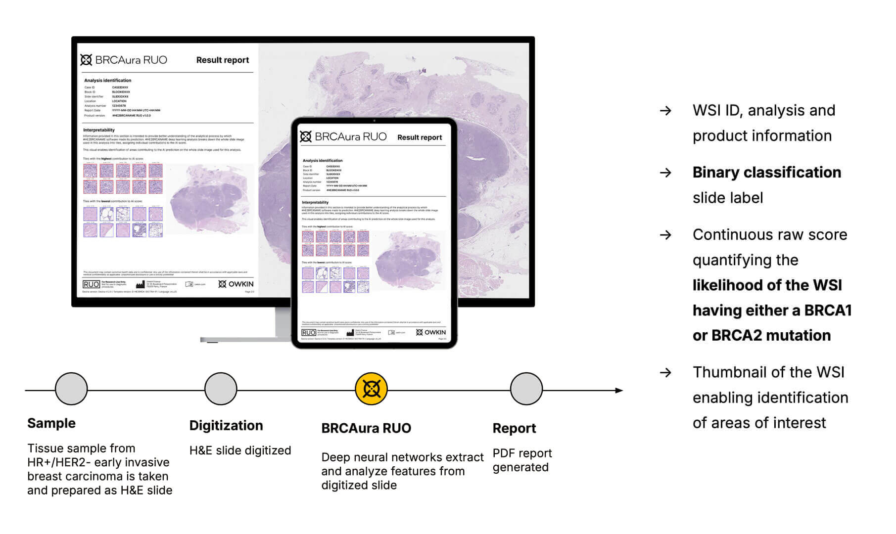 A histology model to predict germline BRCA1/2 mutations from HR+/HER2- breast cancer images