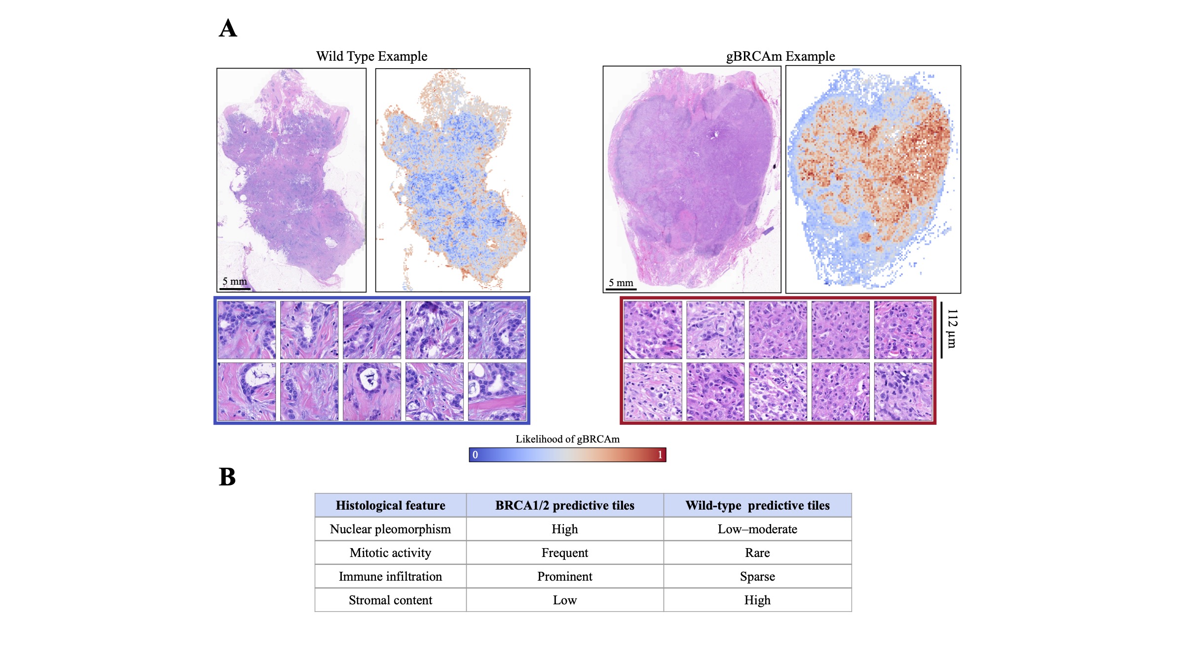 BRCAura heatmaps of two breast tumors: mostly blue (low likelihood) for a non-carrier and largely red (high likelihood) for a germline BRCA1 carrier, with magnified tiles showing the tissue features in each.