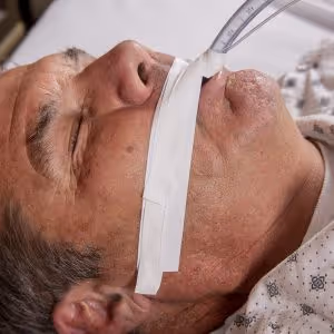 Man with medical tube taped to mouth, lying on a hospital bed.
