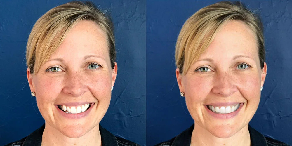 Side-by-side photos of a woman with short blonde hair smiling against a dark blue background.