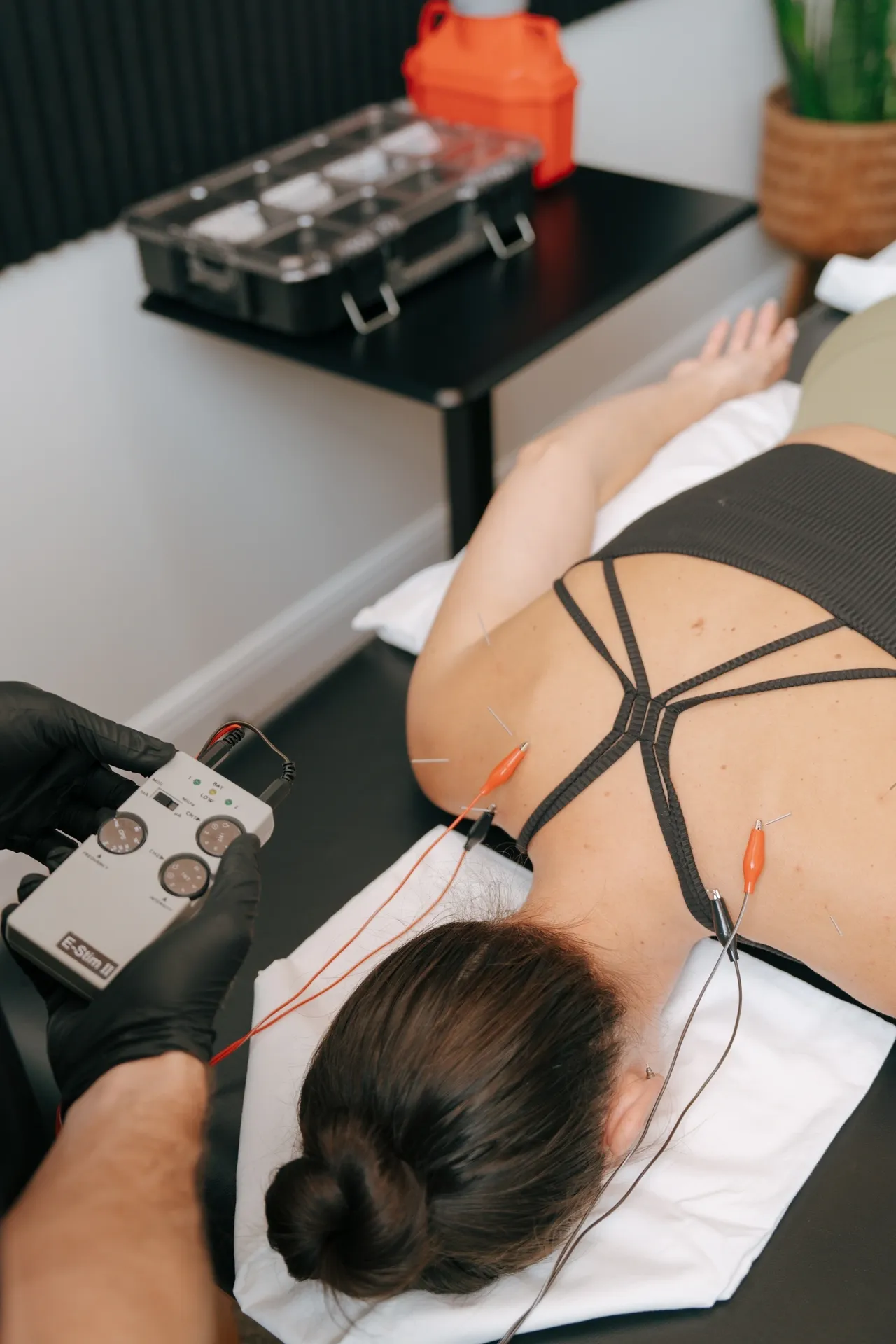 Person lying face down receiving electroacupuncture treatment on the upper back with connected wires and a control device. Tropic Athlete