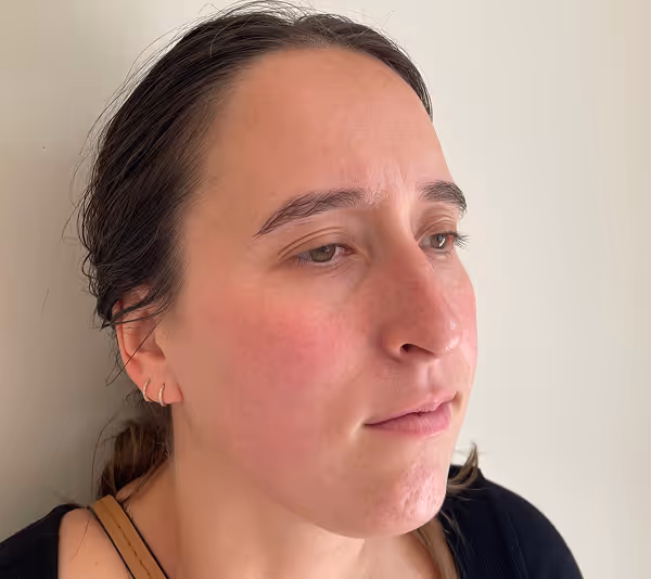 After facial massage side profile with sculpted appearance