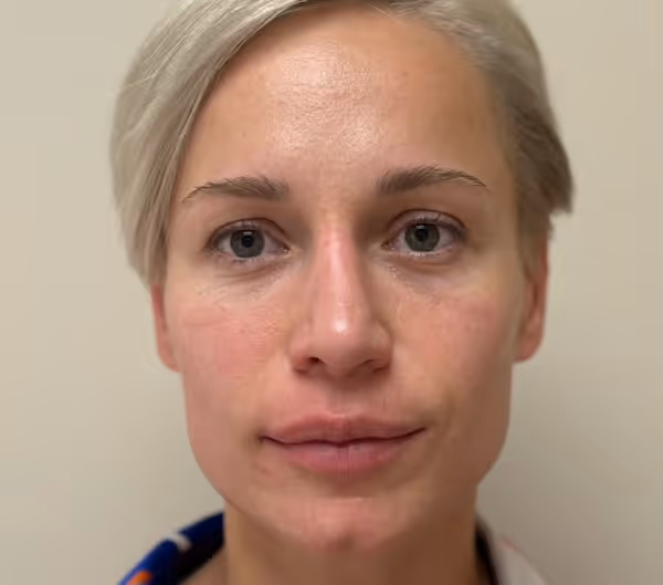 After facial massage 