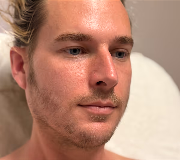 After facial massage side profile with sculpted appearance