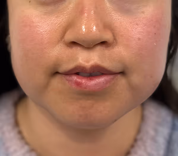 After facial massage 