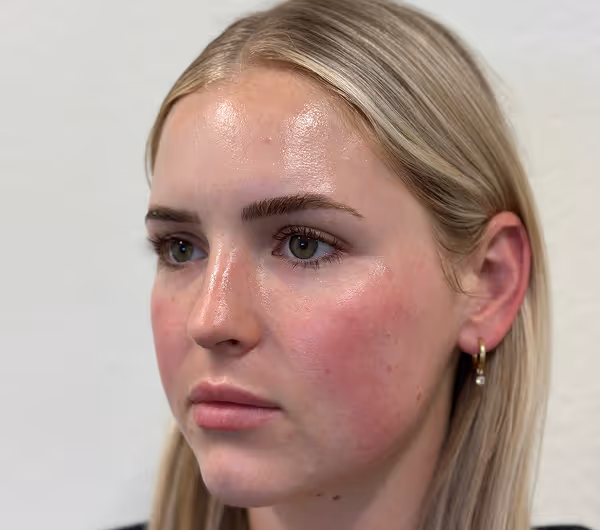 After facial massage side profile with sculpted appearance