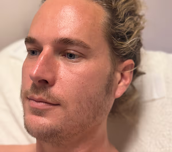 After facial massage side profile with sculpted appearance