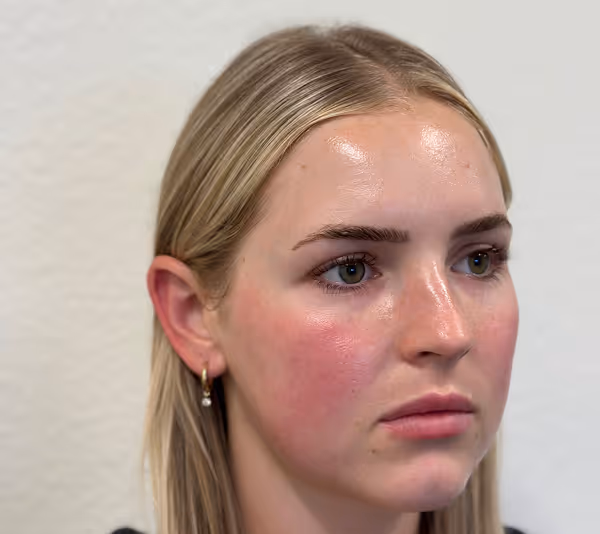 After facial massage side profile with sculpted appearance