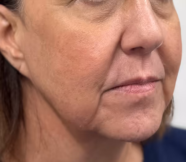 Before facial massage