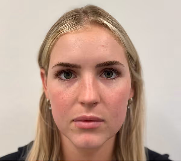 Before facial massage