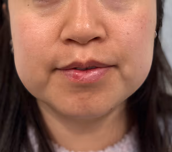 Before facial massage