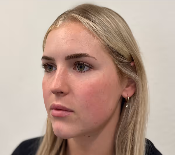 Before facial massage side profile