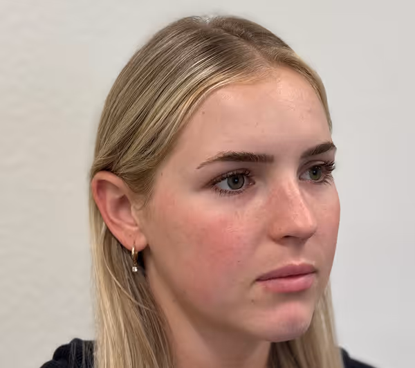 Before facial massage side profile