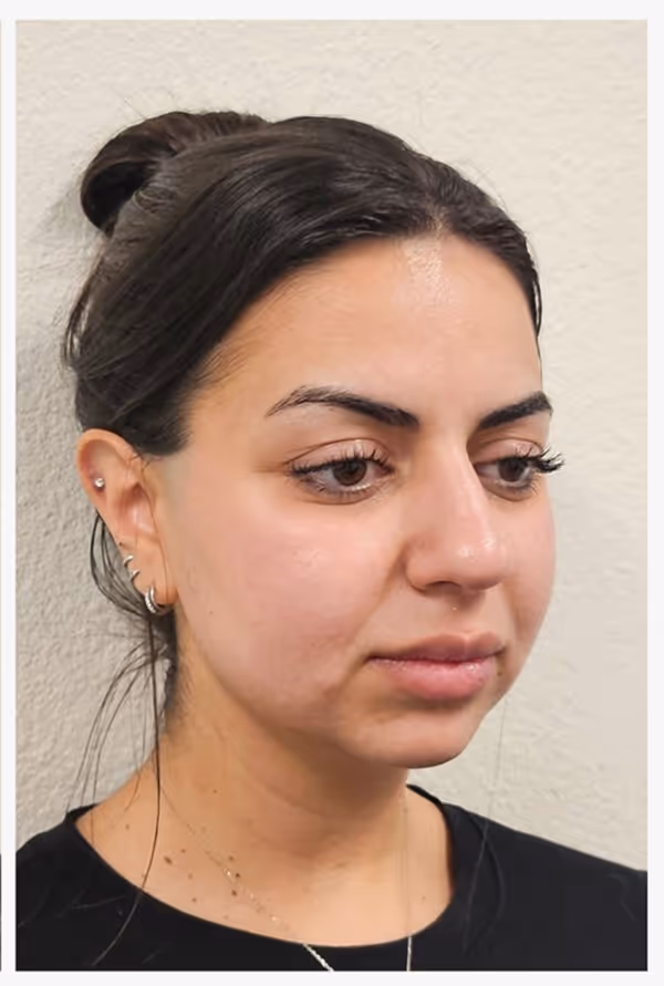 After facial massage side profile with sculpted appearance