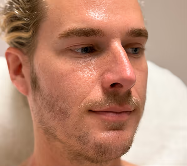 Before facial massage side profile showing natural facial contours