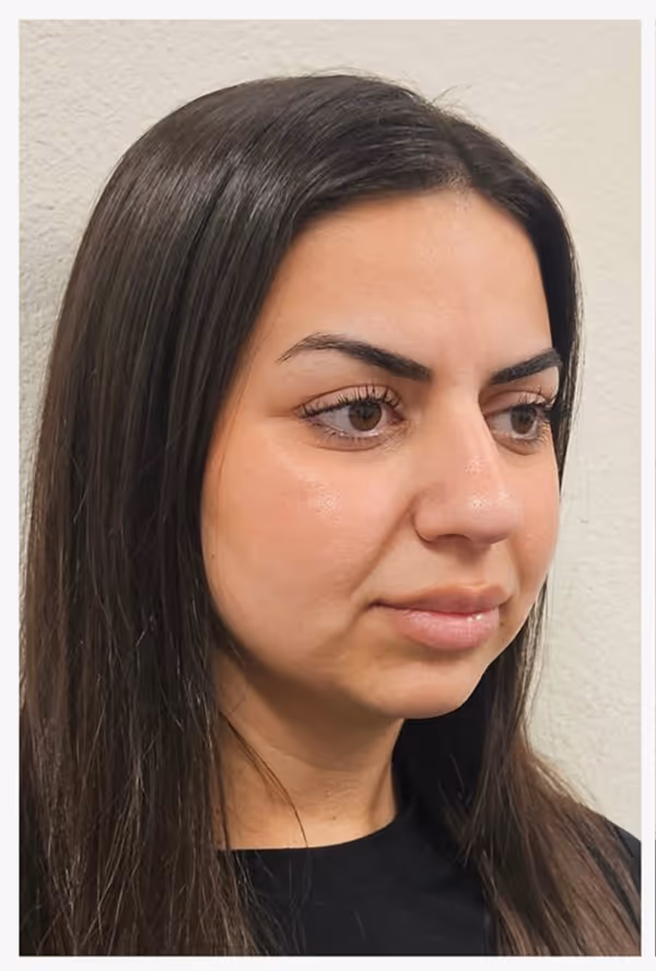 Before facial massage side profile