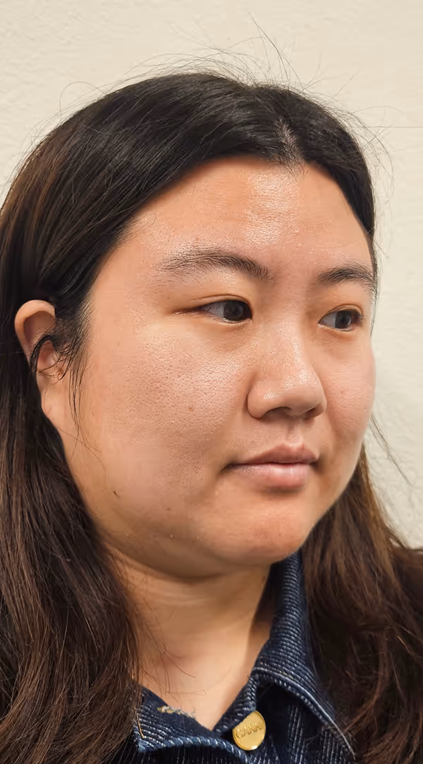 Before facial massage showing natural facial appearance