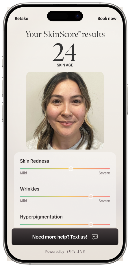 SkinScore-iPhone