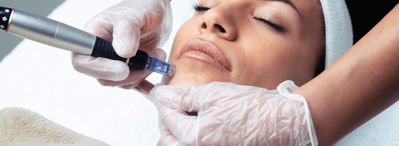 Microneedling for Skin 
