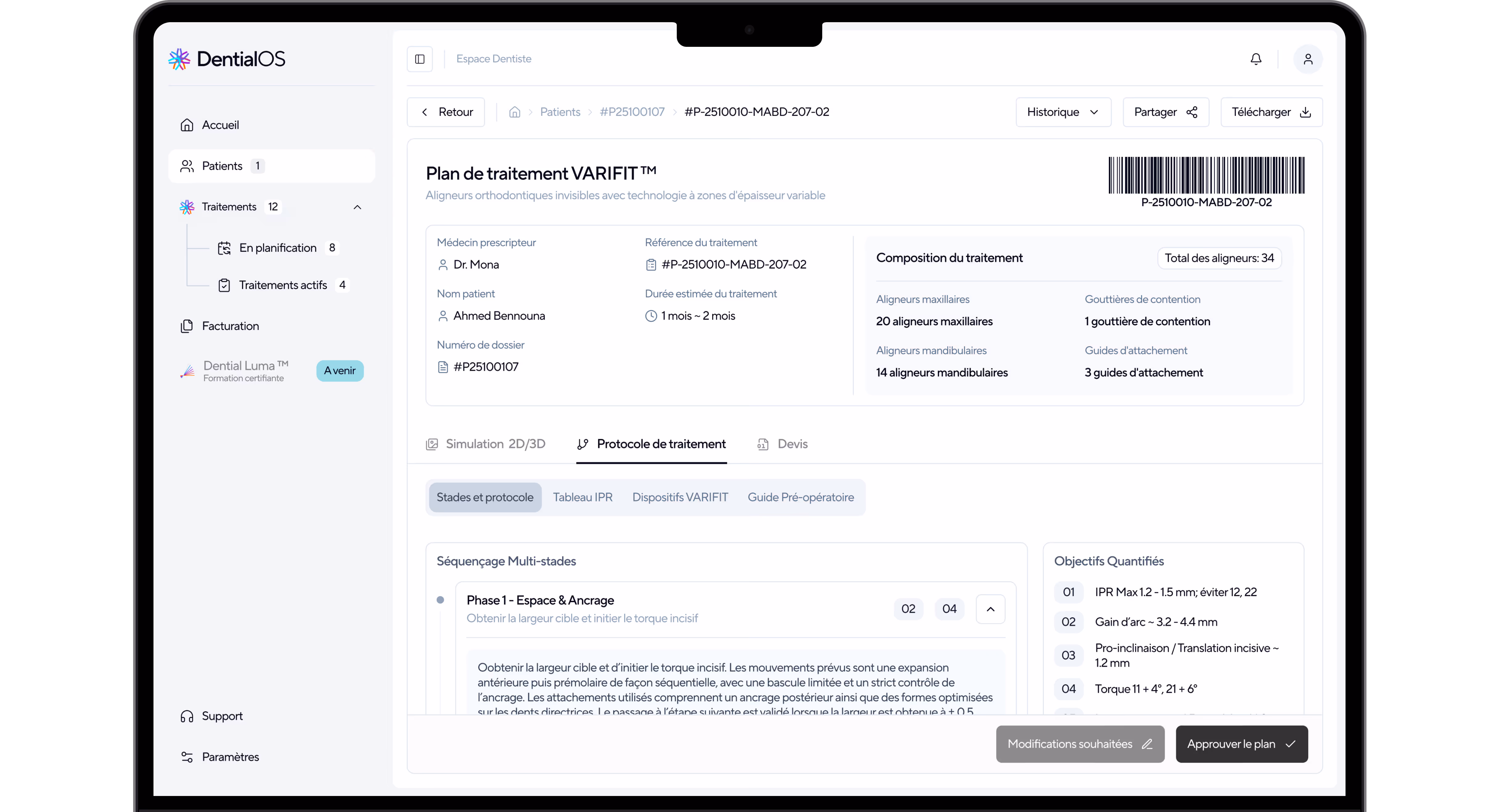 Interface DentialOS sur ordinateur montrant le plan de traitement VARIFIT : prescripteur, patient, durée estimée, composition des aligneurs et onglets Simulation/Protocole/Devis