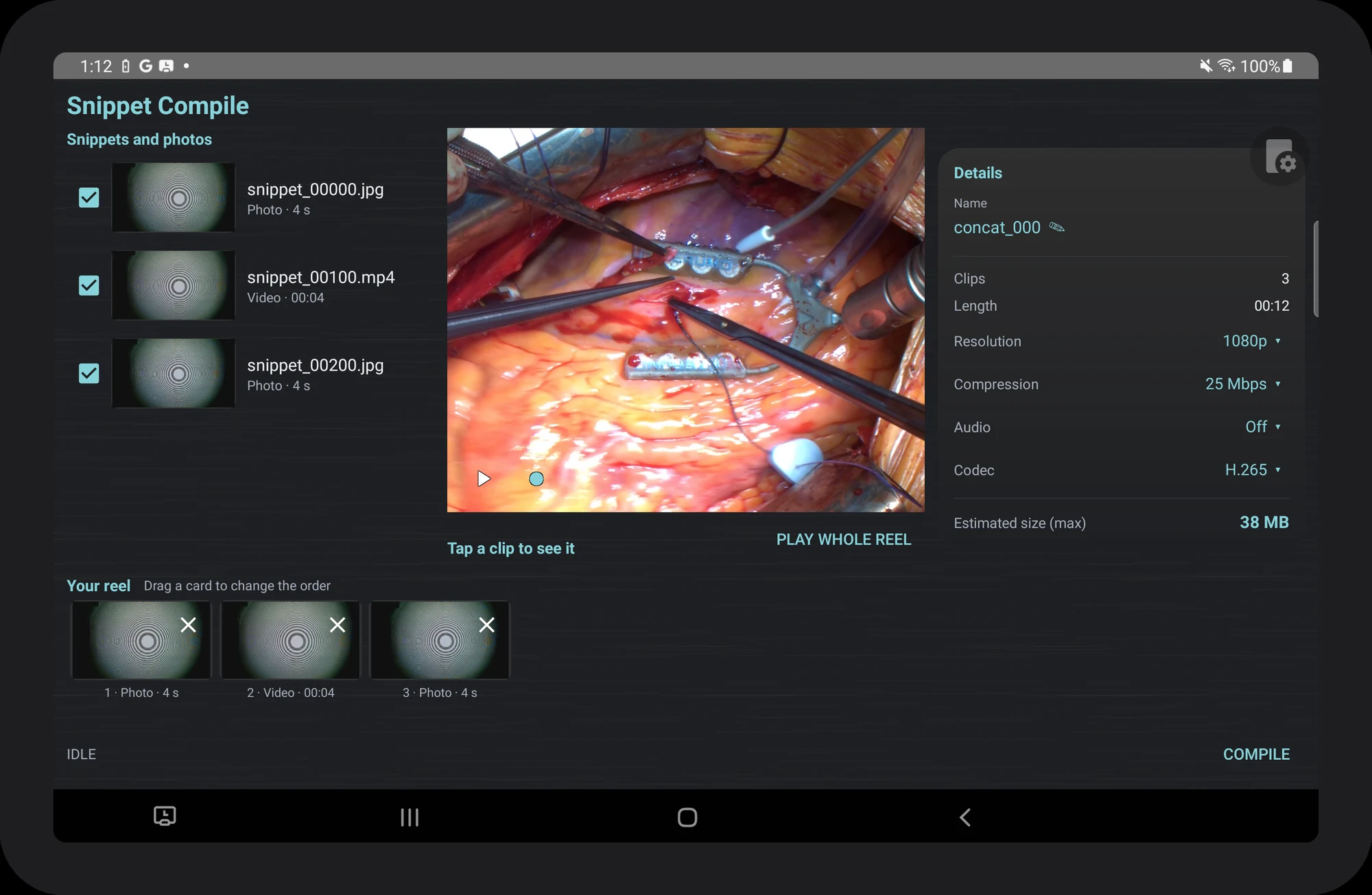 The Snippet Compile screen on the Titan tablet: captured snippets and photos listed on the left, a preview player in the middle, and output settings for name, resolution, compression, audio and codec on the right, with a drag-to-reorder reel along the bottom.