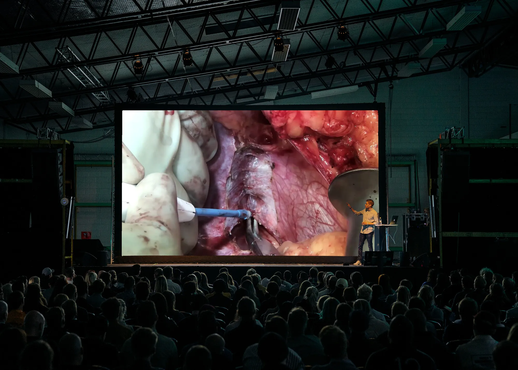 A packed lecture hall watching a live 4K surgical feed on a large screen while a presenter speaks from the stage beside it.
