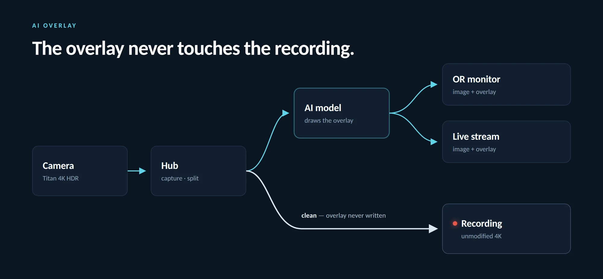 Signal path diagram: the Titan 4K HDR camera feeds the hub, which splits the feed two ways — one branch to an AI model that draws an overlay onto the OR monitor and the live stream, and a separate clean branch to the recording, which stays unmodified 4K.
