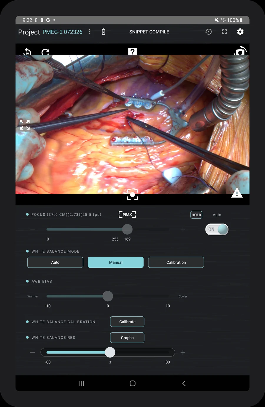 The Titan tablet control screen showing the live surgical view above focus distance, sharpness and frame rate readouts, white balance mode set to Manual, an AWB bias slider from warmer to cooler, a calibration button and a white balance red trim slider.