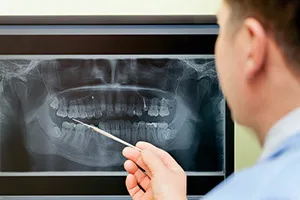 Person pointing at a dental X-ray displayed on a screen.