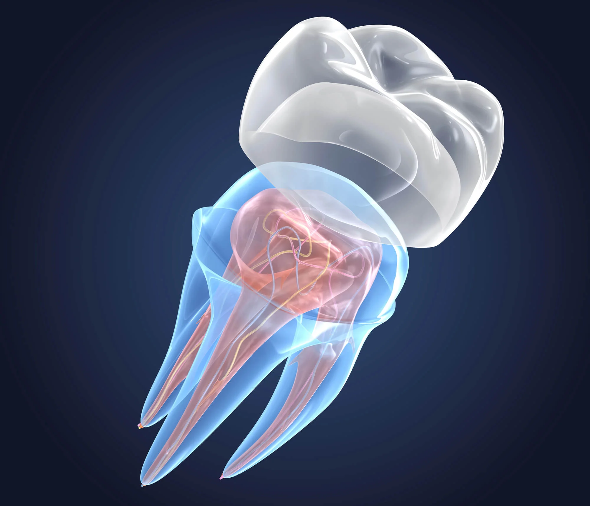 3D rendering of transparent teeth showing dental crowns in Broomall.
