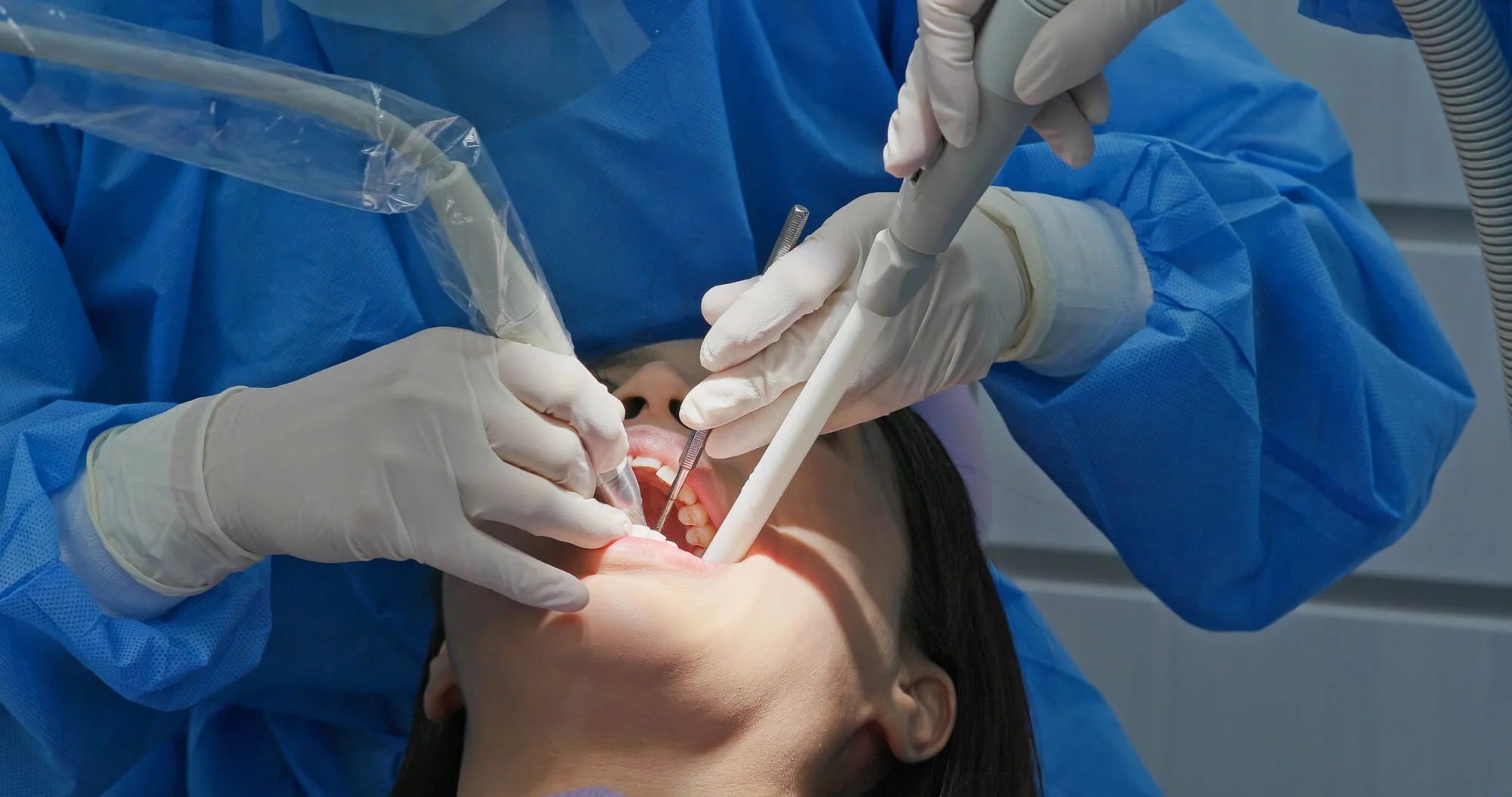 Tooth extractions in Havertown.