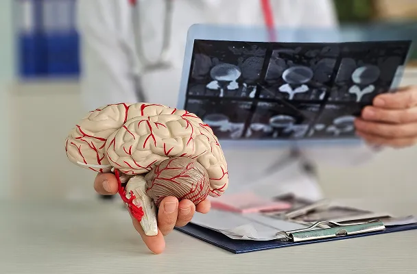 Doctor holding a detailed anatomical model of a human brain with red blood vessels, while examining brain scan X-rays.