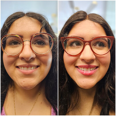 Side-by-side comparison of a smiling woman wearing glasses, showing a before and after of aesthetic treatment with visible improvements in skin tone, lip color, and overall facial appearance.