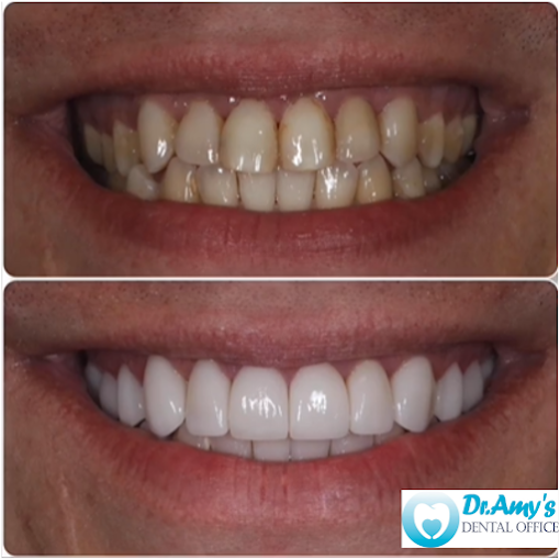 Cosmetic dental makeover results