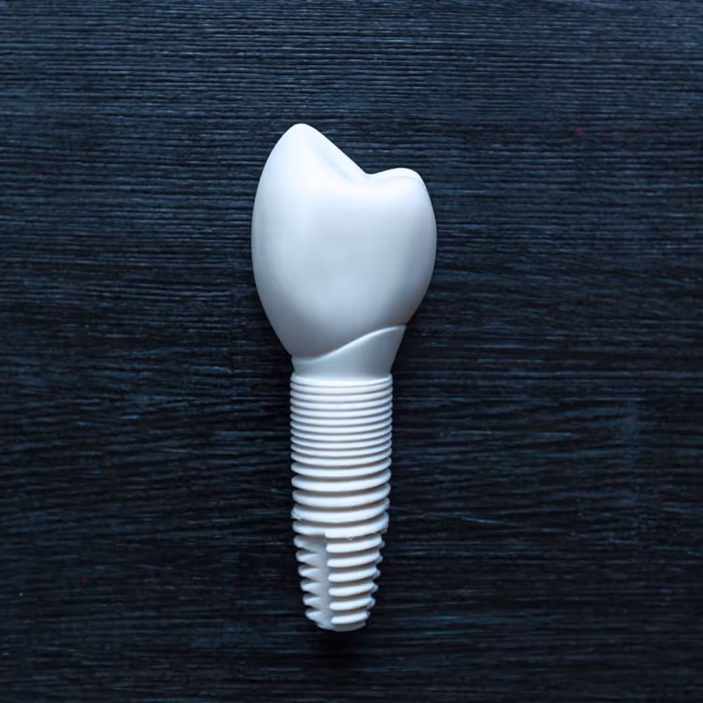 Biocompatible ceramic implant replacing a missing tooth