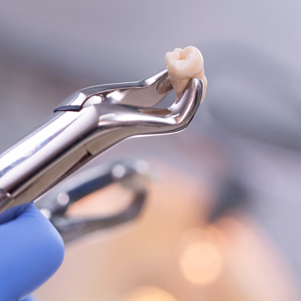 Atraumatic tooth extraction technique