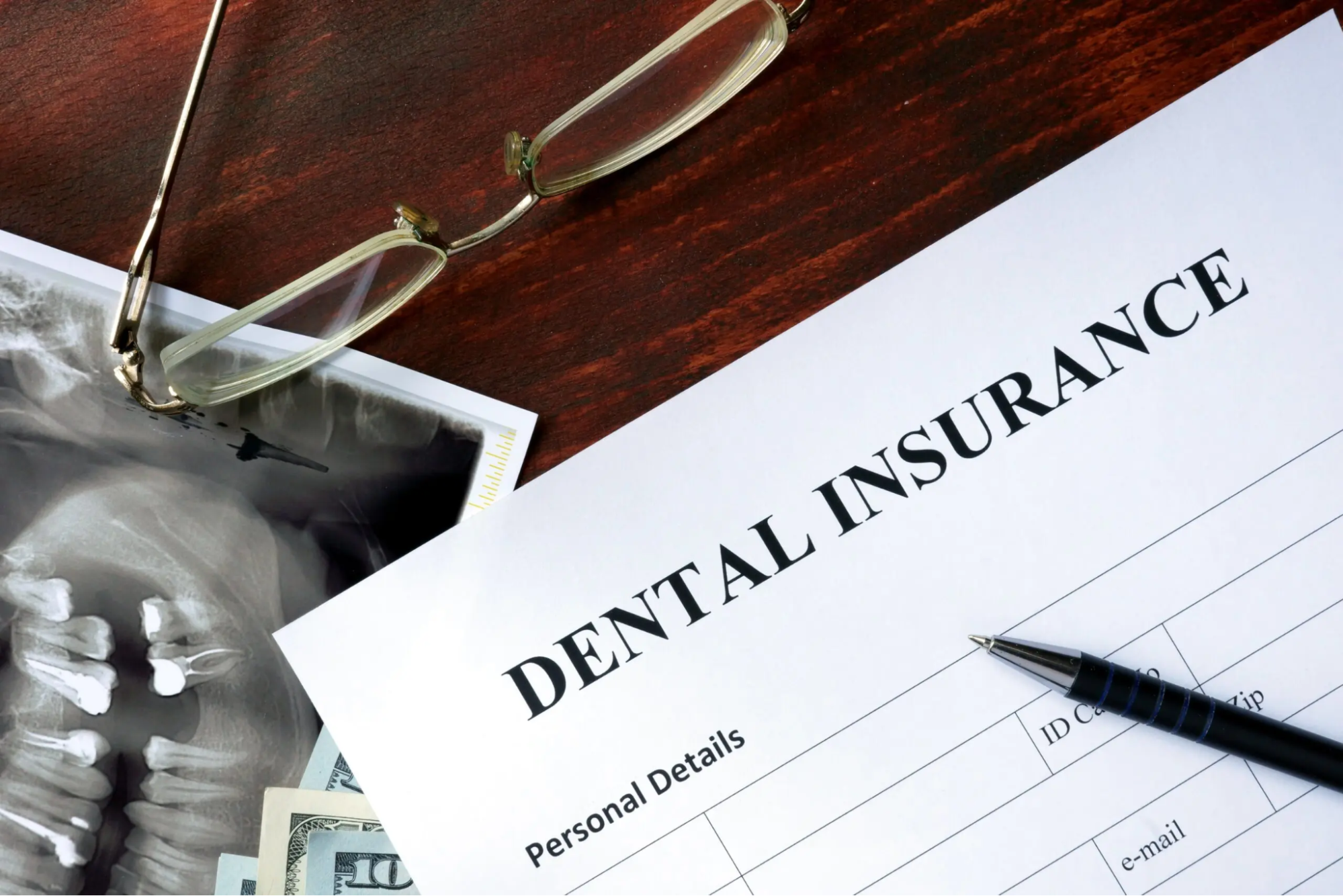 Dental Implant Insurance Explained: What’s Covered And What’s Not