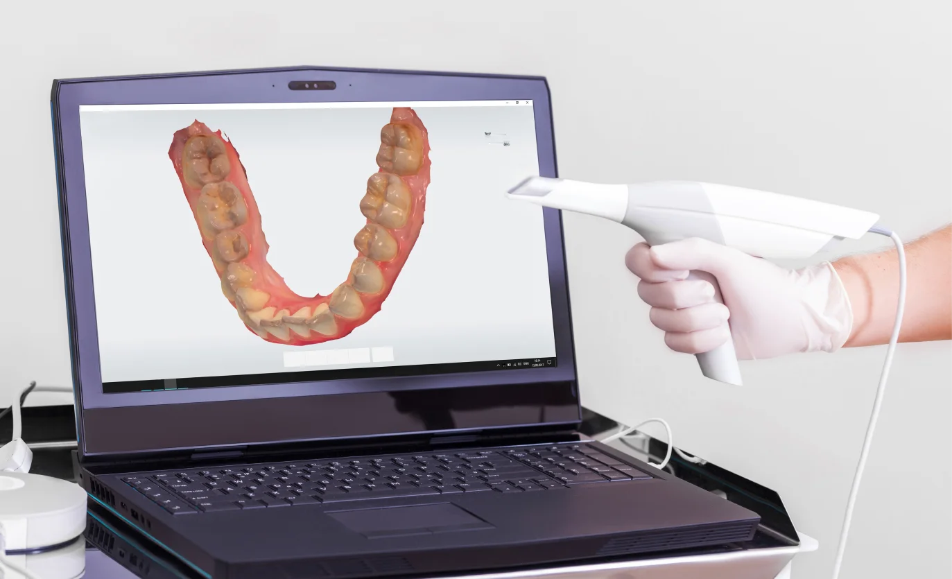 A laptop with a picture of a tooth on the screen.