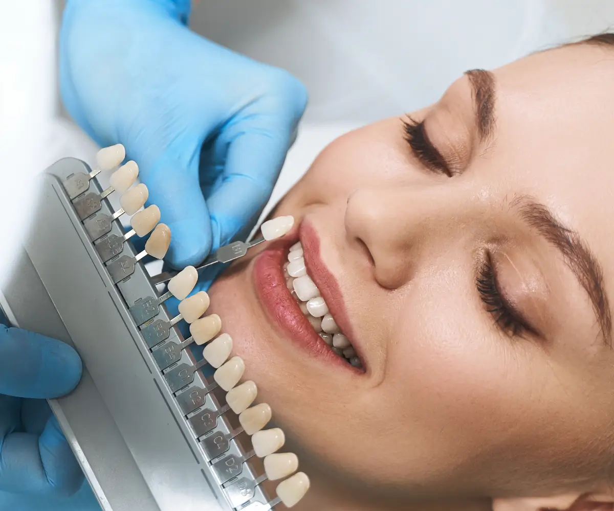 A dentist matches tooth color with a shade guide for a smiling patient.