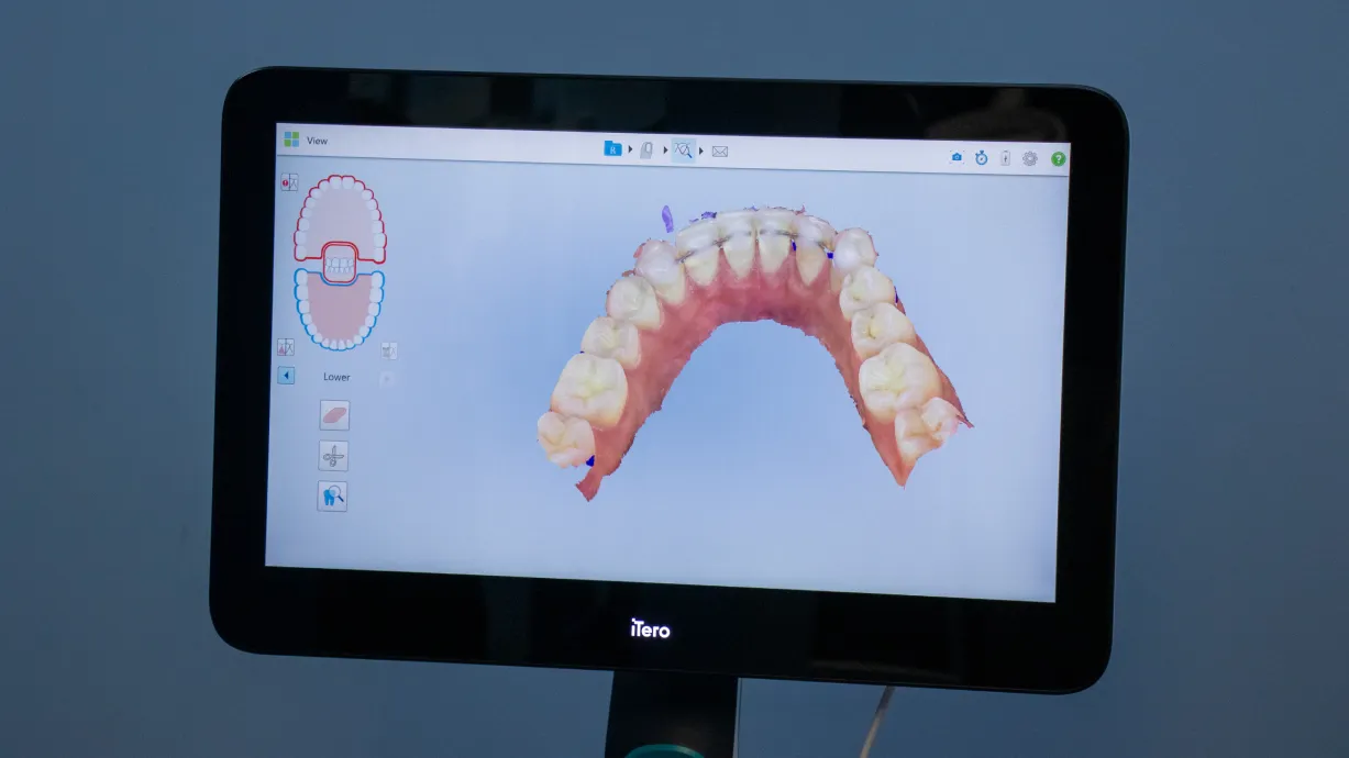 A dentist and a patient smile in a dental office. The dentist points playfully at the camera.