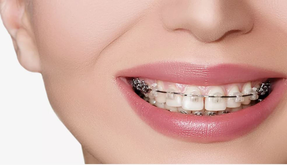 Comprehensive Dental Care for Healthy and Beautiful Smiles