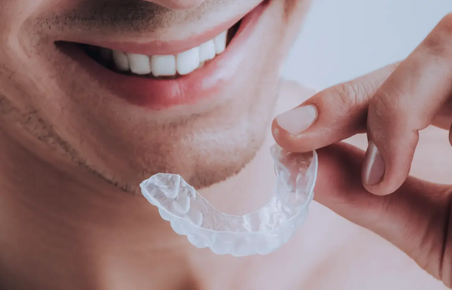 Clear aligners