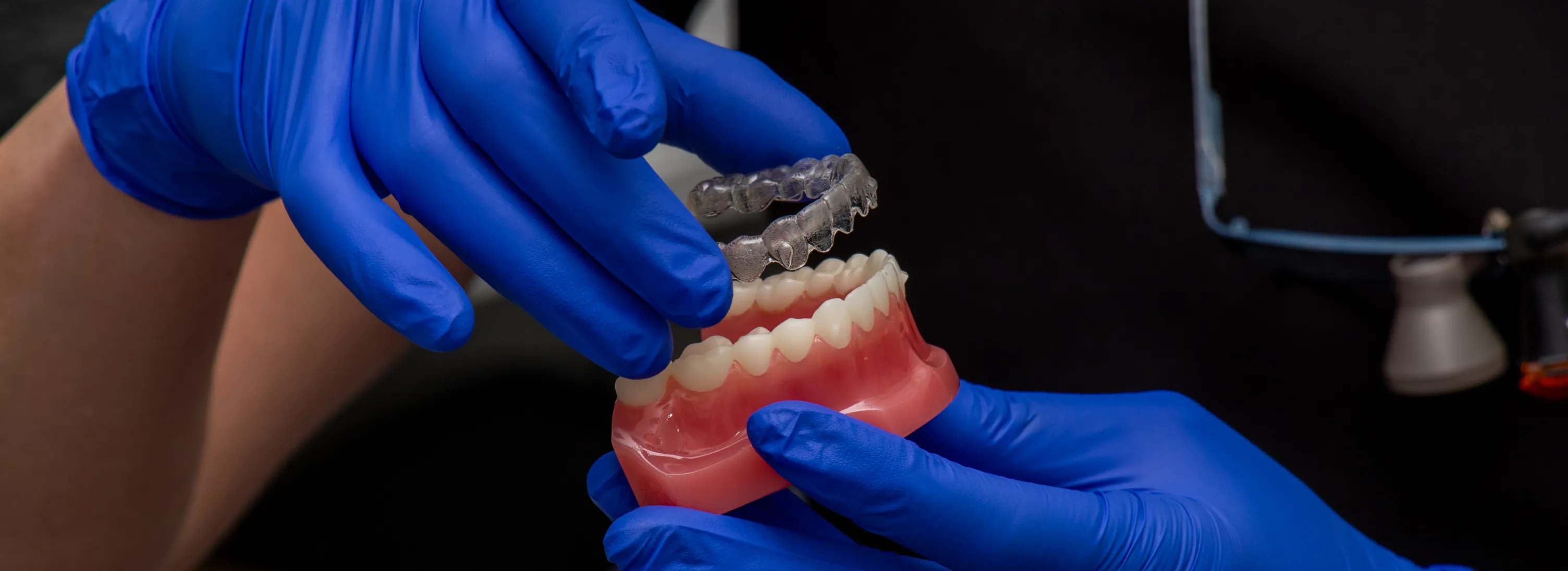 A person wearing blue gloves places a clear dental aligner onto a model of teeth.