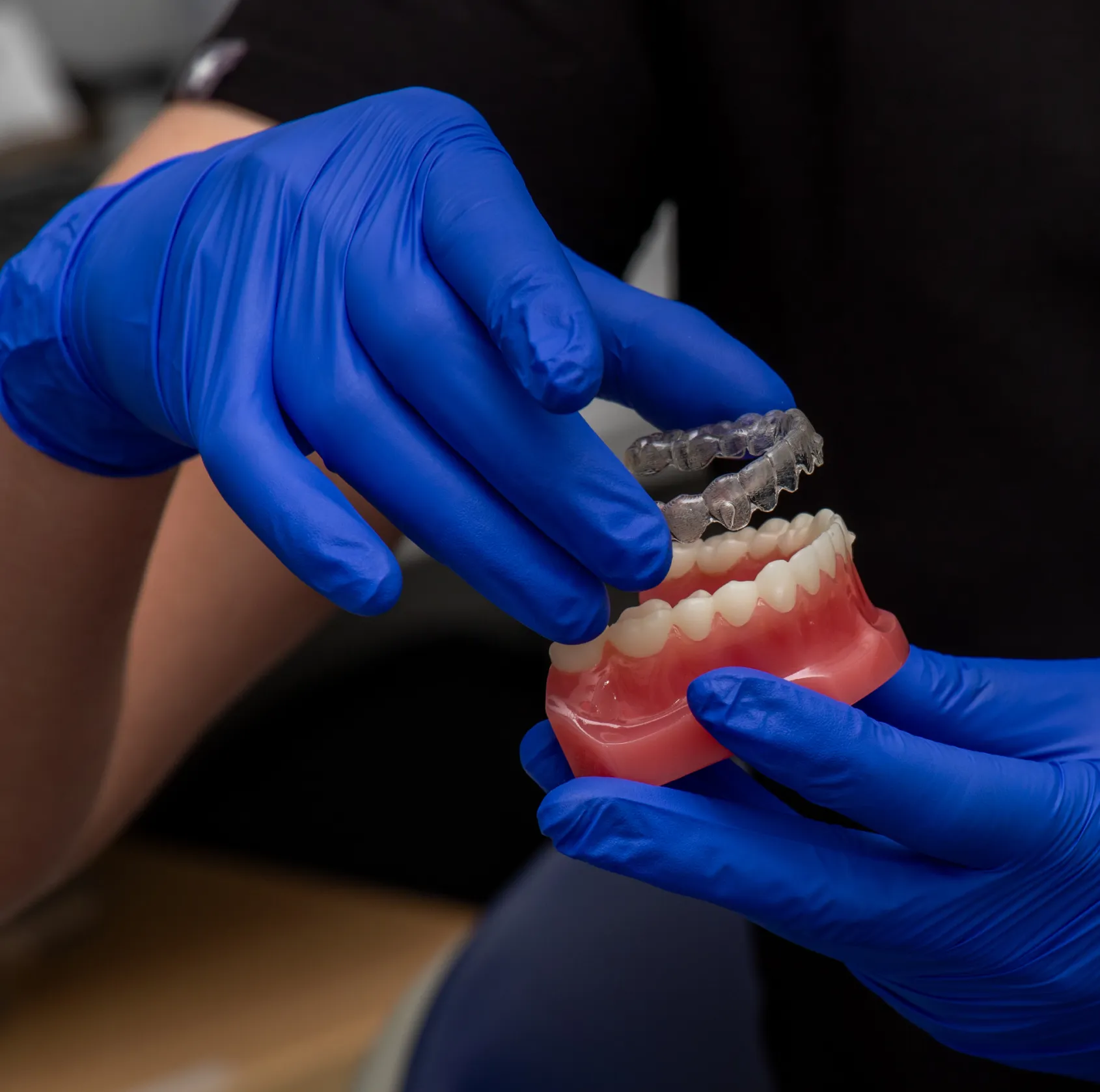 team member showing how clear aligners work with a denture