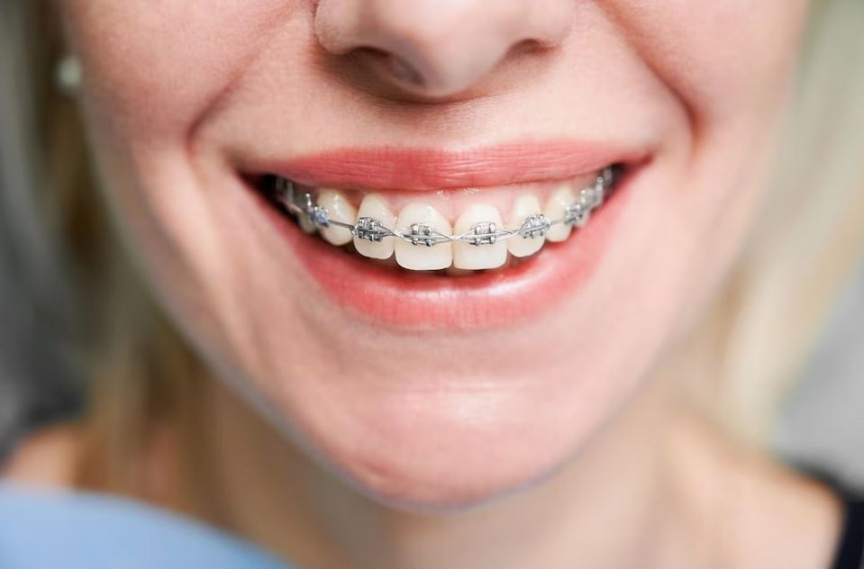 Modern Dental Care in Oshawa Focused on Accessibility, Comfort, and Long-Term Results