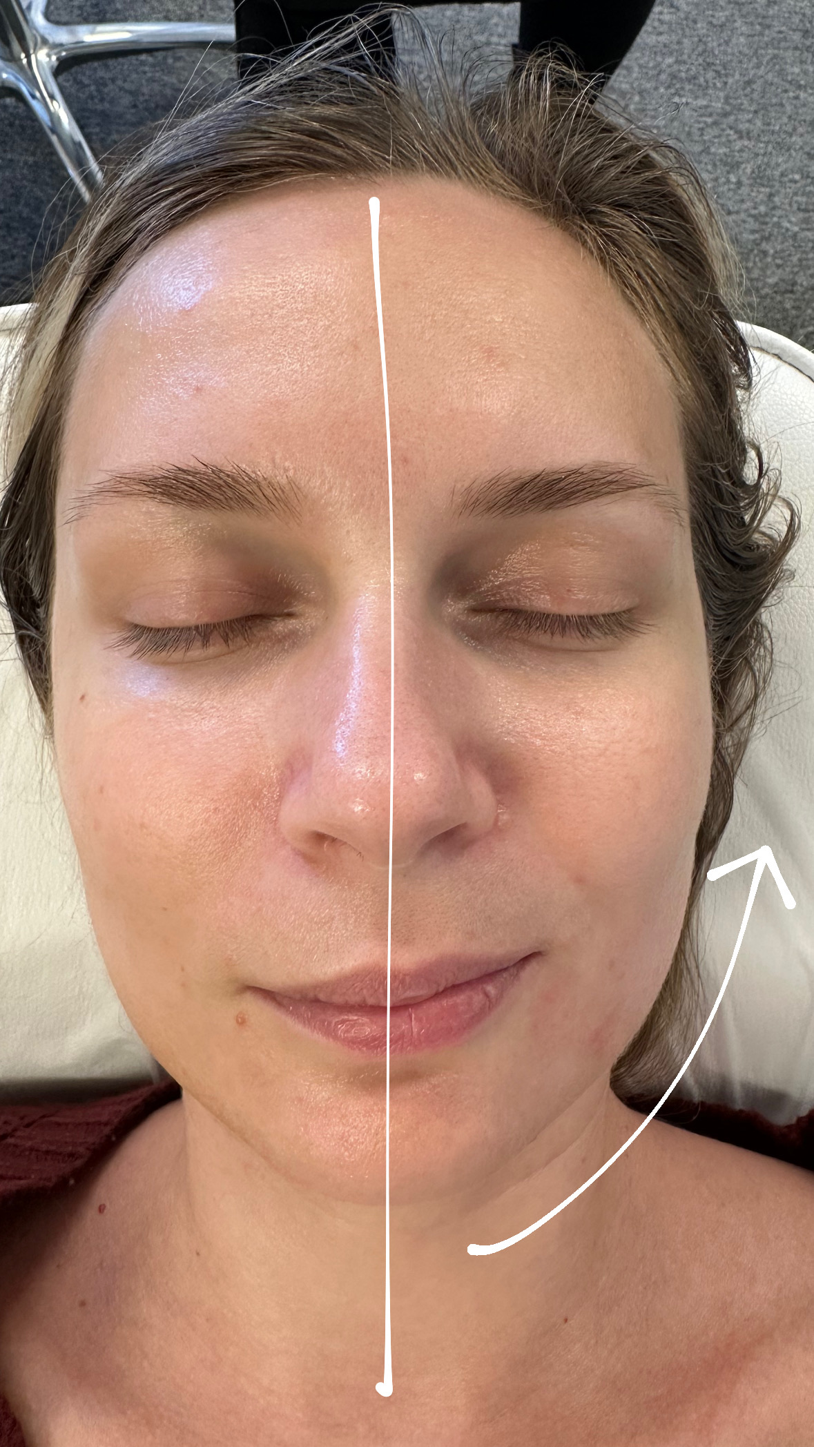  buccal massage creates a lifting effect