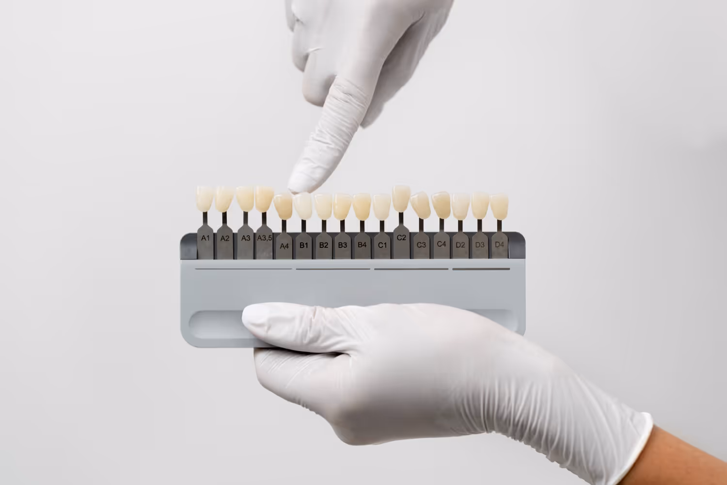 Zahnfarbmusterkarte mit verschiedenen Zahnfarben, gehalten und gezeigt von Händen mit weißen Handschuhen.